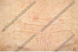 human skin wrinkled 0004